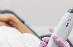 What to Know Before AviClear Acne Treatments