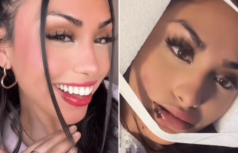 This TikToker Got Hit by a Car, and Her Makeup Didn’t Budge
One Bit — See Photos