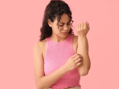 Cucumber to coriander: 10 home remedies for heat rash to soothe your skin