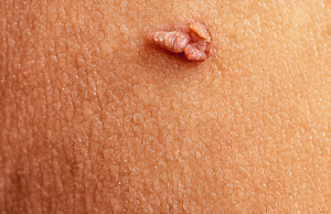 Why Over-Skincare Is the New Skin Problem (Yes, Really)