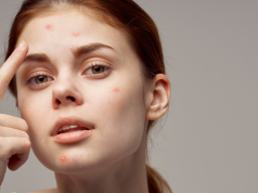 Why “Hypoallergenic” Means Almost Nothing (And What Actually Matters)