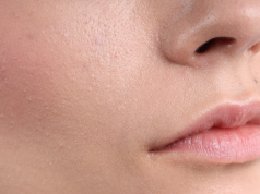 Sensitive Skin Isn’t Weak — It’s Overstimulated