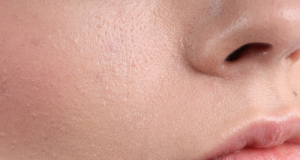 Sensitive Skin Isn’t Weak — It’s Overstimulated