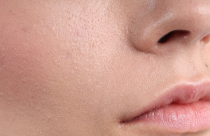 Sensitive Skin Isn’t Weak — It’s Overstimulated