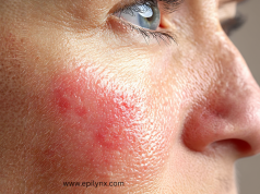 Common Causes of Sensitive Skin and How Hypoallergenic Care Helps